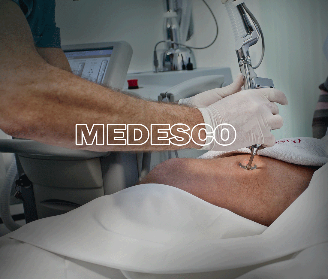 Лазер для видалення шрамів і розтяжок на тілі