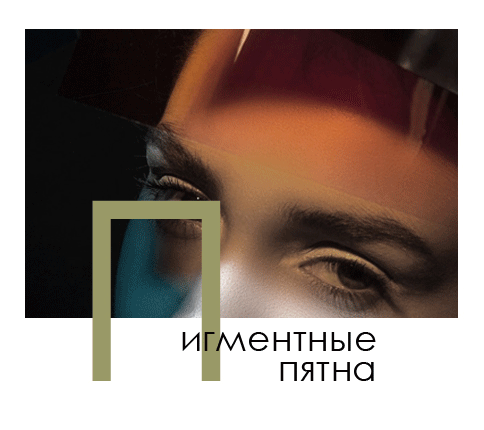 Пігментні плями